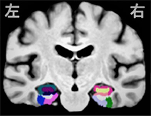 Brush up Program for professional