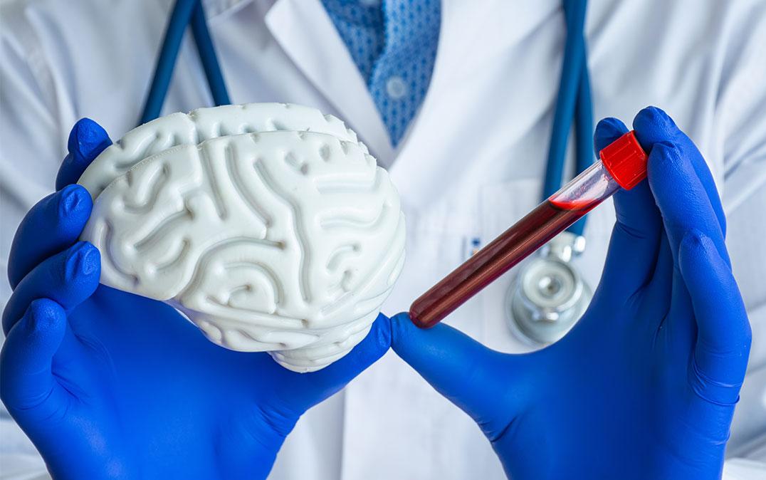 研究イメージ画像