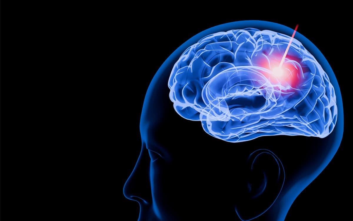 研究イメージ画像