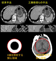 （対象となった研究成果の中から低被曝を実現する「スパースビューCT」と「インテリアCT」の画像再構成例（上段：通常の約1/40に相当する僅か40方向のスパースビューCT投影データからの腹部CT画像の再構成，下段：検査の関心領域のみにＸ線を照射したインテリアCT投影データからの頭部CT画像の再構成））